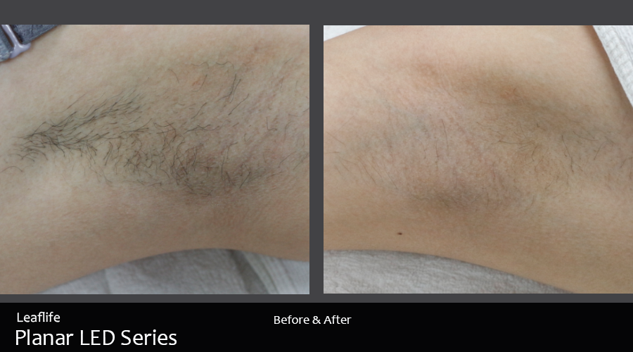 before_after_LED_4.png